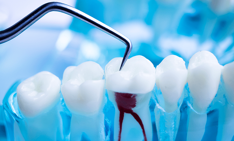 Dental SEO For Endodontists