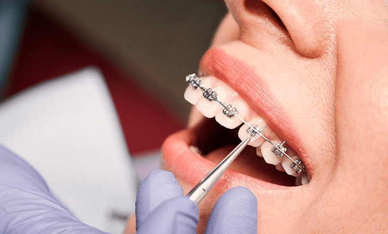 Dental SEO For Orthodontists