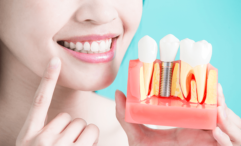 Dental SEO For Prosthodontists